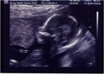 ultrasound4